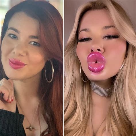 Halle Hayes before and after surgery : r/bimbofication